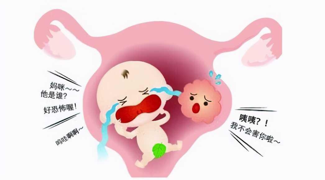 子宫肌瘤备孕(备孕期发现子宫肌瘤怎么办) 子宫肌瘤备孕(备孕期发现子宫肌瘤怎么办)