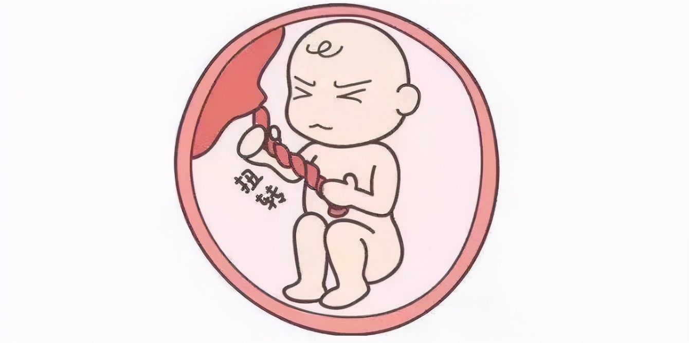 孕妇缺氧(孕期出现某些情况表示胎儿缺氧了) 孕妇缺氧(孕期出现某些情况表示胎儿缺氧了)