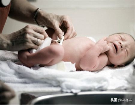 新生儿脐炎(新生儿的脐炎怎么办) 新生儿脐炎(新生儿的脐炎怎么办)