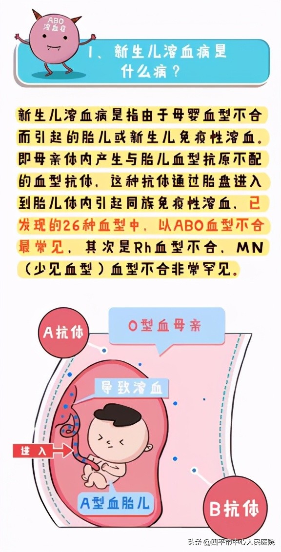 新生儿溶血(新生儿溶血病预防指南) 新生儿溶血(新生儿溶血病预防指南)
