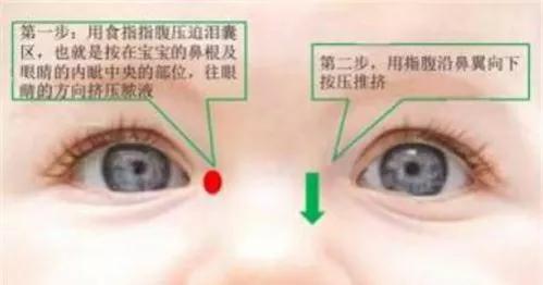 新生儿眼屎(新生儿眼屎多怎么办) 新生儿眼屎(新生儿眼屎多怎么办)