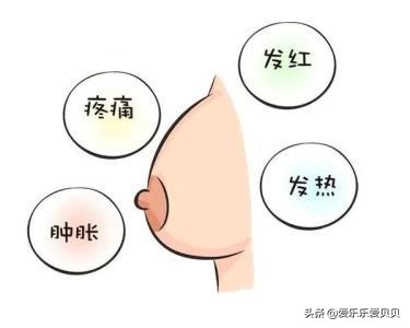 产后乳房胀痛(产后涨奶疼痛的原因) 产后乳房胀痛(产后涨奶疼痛的原因)