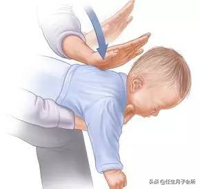 幼儿急救(婴幼儿急救知识) 幼儿急救(婴幼儿急救知识)