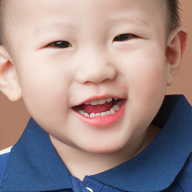 幼儿白斑(宝宝脸上的白斑是啥) 幼儿白斑(宝宝脸上的白斑是啥)