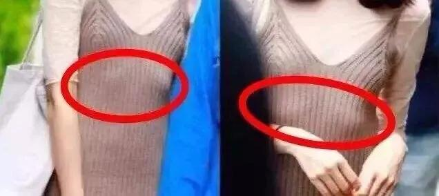产后肋骨外翻(产后体态问题之肋骨外翻) 产后肋骨外翻(产后体态问题之肋骨外翻)