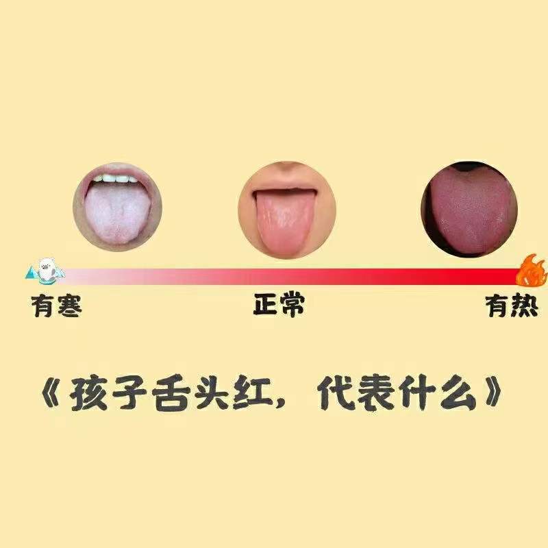 新生儿舌苔(教你学会看孩子舌苔) 新生儿舌苔(教你学会看孩子舌苔)