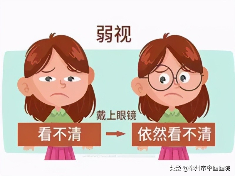 幼儿弱视(可怕的儿童视力杀手弱视) 幼儿弱视(可怕的儿童视力杀手弱视)