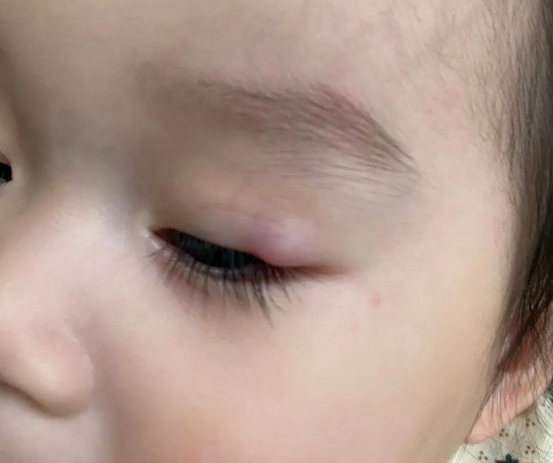 新生儿睫毛(宝宝睫毛长虽然好看但是对眼睛的危害也不少) 新生儿睫毛(宝宝睫毛长虽然好看但是对眼睛的危害也不少)