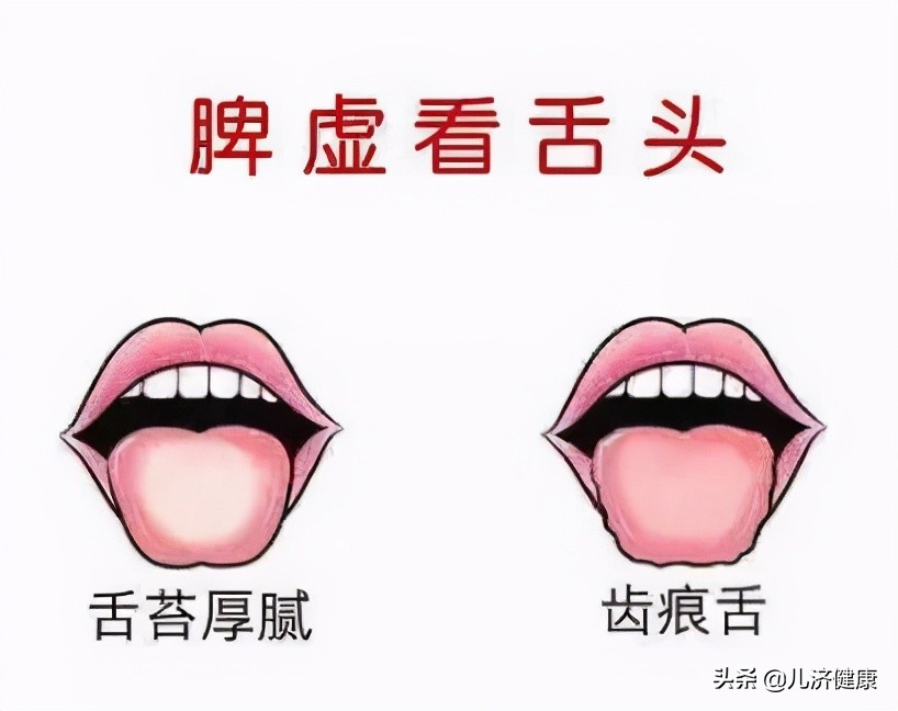 幼儿健脾(孩子脾虚危害大) 幼儿健脾(孩子脾虚危害大)