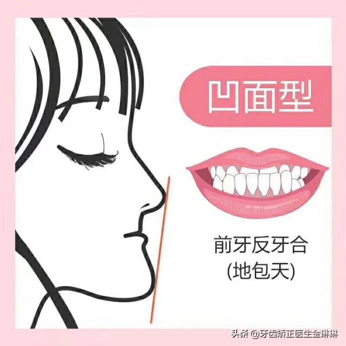 备孕能整牙吗(备孕期可以整牙吗) 备孕能整牙吗(备孕期可以整牙吗)