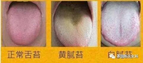 备孕提高精子质量的药(男人备孕提高精子质量的方法) 备孕提高精子质量的药(男人备孕提高精子质量的方法)