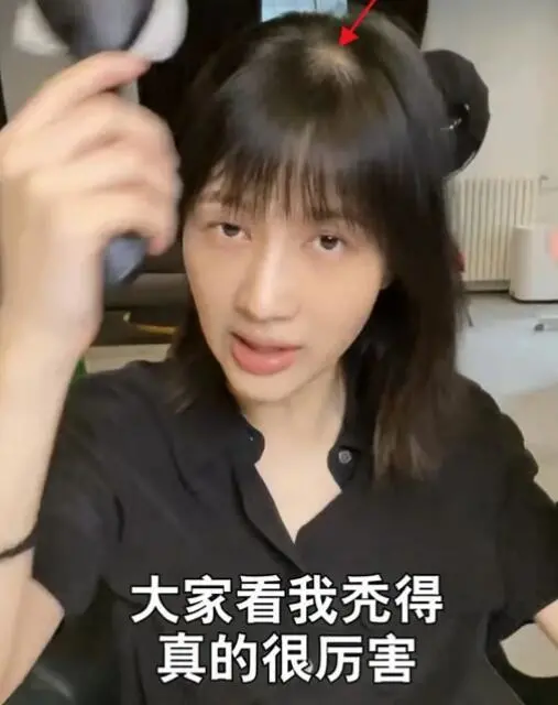 产后三个月掉头发怎么回事(产后三个月头皮痒掉头发是怎么回事) 产后三个月掉头发怎么回事(产后三个月头皮痒掉头发是怎么回事)