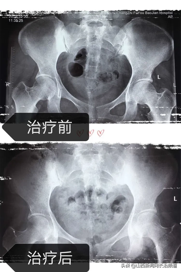 产后42天体检需要空腹吗(产后42天需要什么) 产后42天体检需要空腹吗(产后42天需要什么)