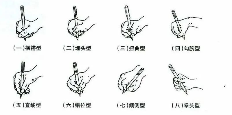 新生儿手腕内扣(新生儿手腕内扣正常吗) 新生儿手腕内扣(新生儿手腕内扣正常吗)