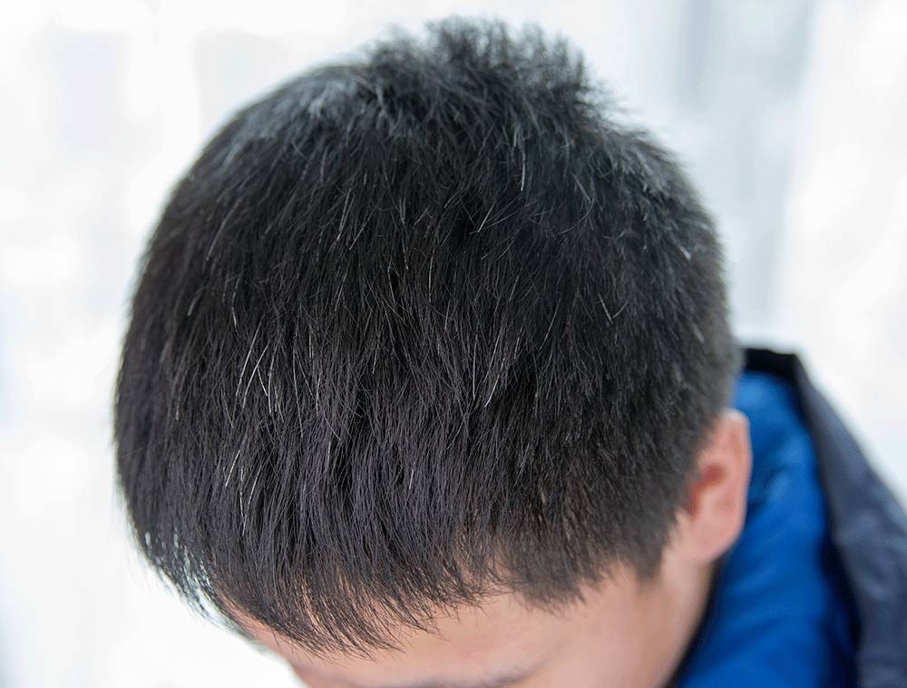 幼儿白头发是什么原因(两鬓白头发是什么原因引起的) 幼儿白头发是什么原因(两鬓白头发是什么原因引起的)