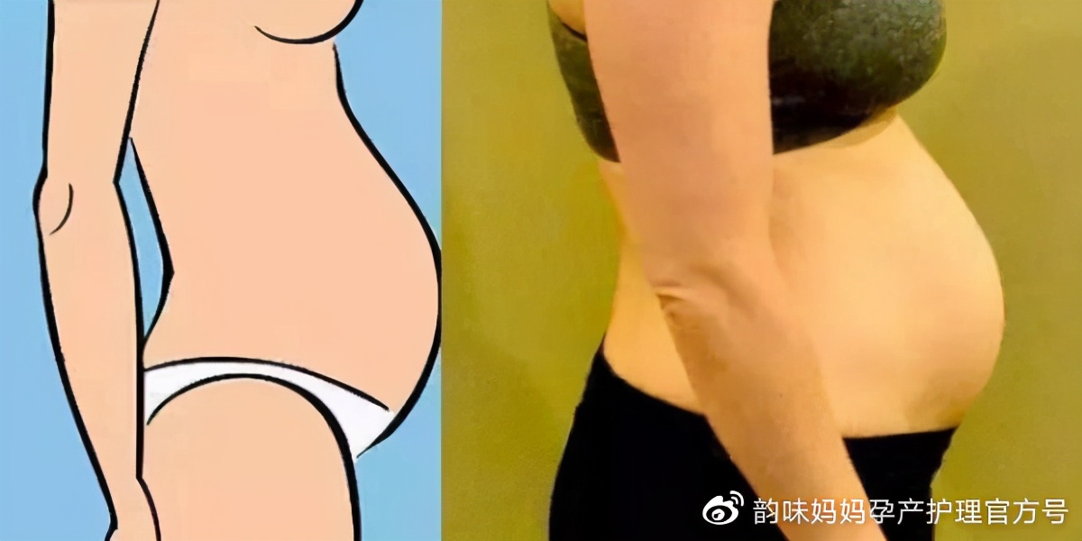 产后小肚子大怎么减掉(破腹产后小肚子怎么减掉) 产后小肚子大怎么减掉(破腹产后小肚子怎么减掉)